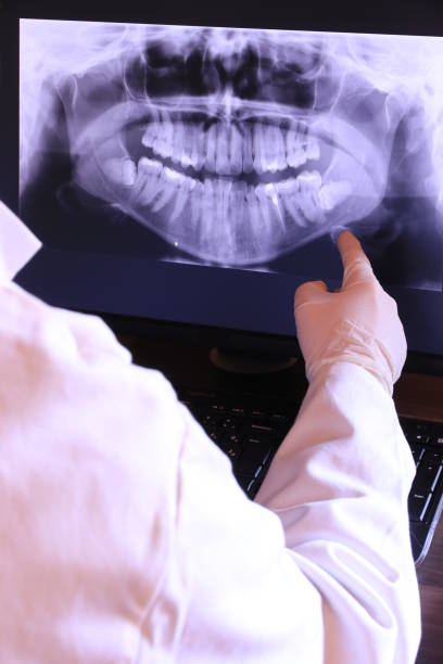 Best Emergency Dental Care for Abscessed Tooth in Jonestown, TX