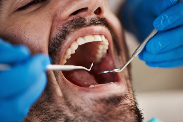Best Emergency Dentist for Knocked-Out Tooth in Jonestown, TX