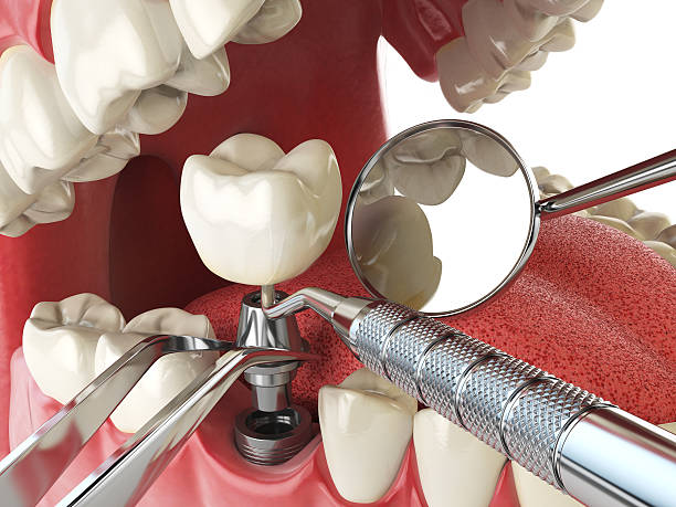 Best Urgent Dental Care for Toothache in Jonestown, TX
