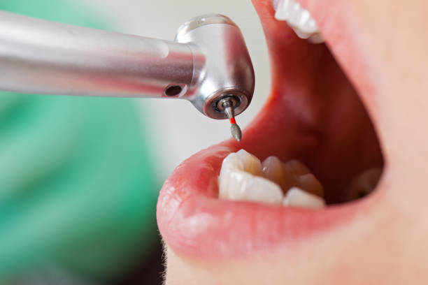 Best Mobile Emergency Dentist in Jonestown, TX